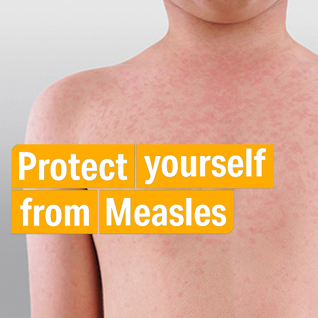 Protect yourself from measles