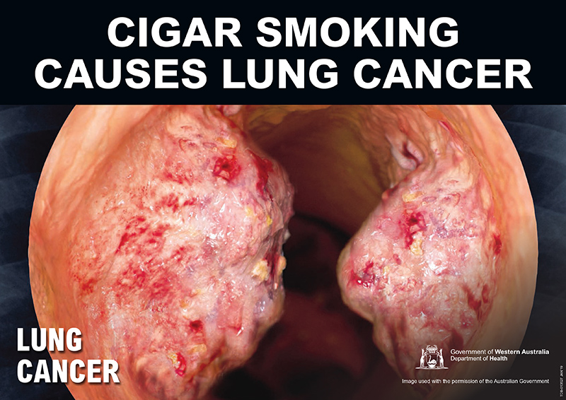 Banner: cigar smoking causes lung cancer