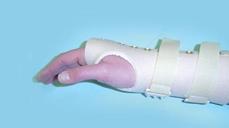 Right arm in splint